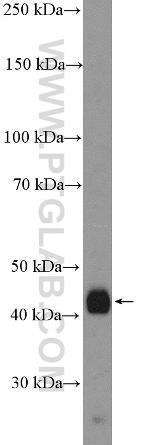 XYLB Antibody in Western Blot (WB)