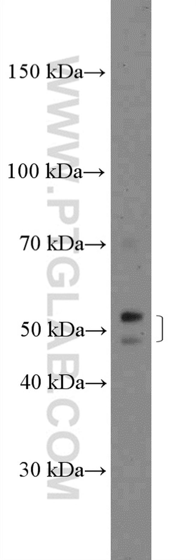 ZDHHC1 Antibody in Western Blot (WB)