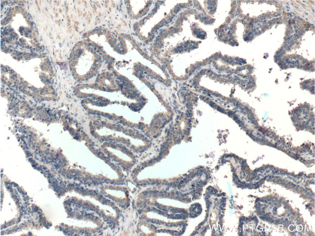 KLK4 Antibody in Immunohistochemistry (Paraffin) (IHC (P))