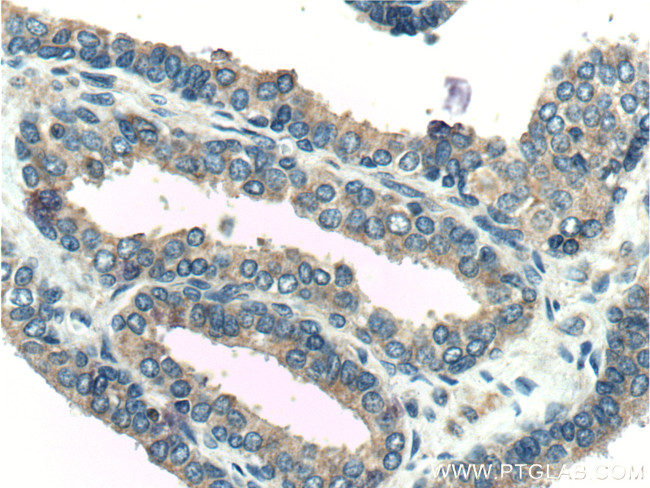 KLK4 Antibody in Immunohistochemistry (Paraffin) (IHC (P))