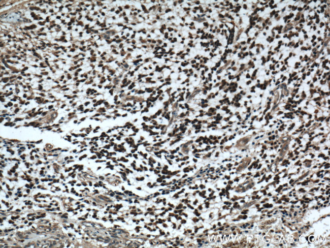 Phospholipase C beta 1 Antibody in Immunohistochemistry (Paraffin) (IHC (P))