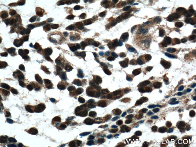 Phospholipase C beta 1 Antibody in Immunohistochemistry (Paraffin) (IHC (P))