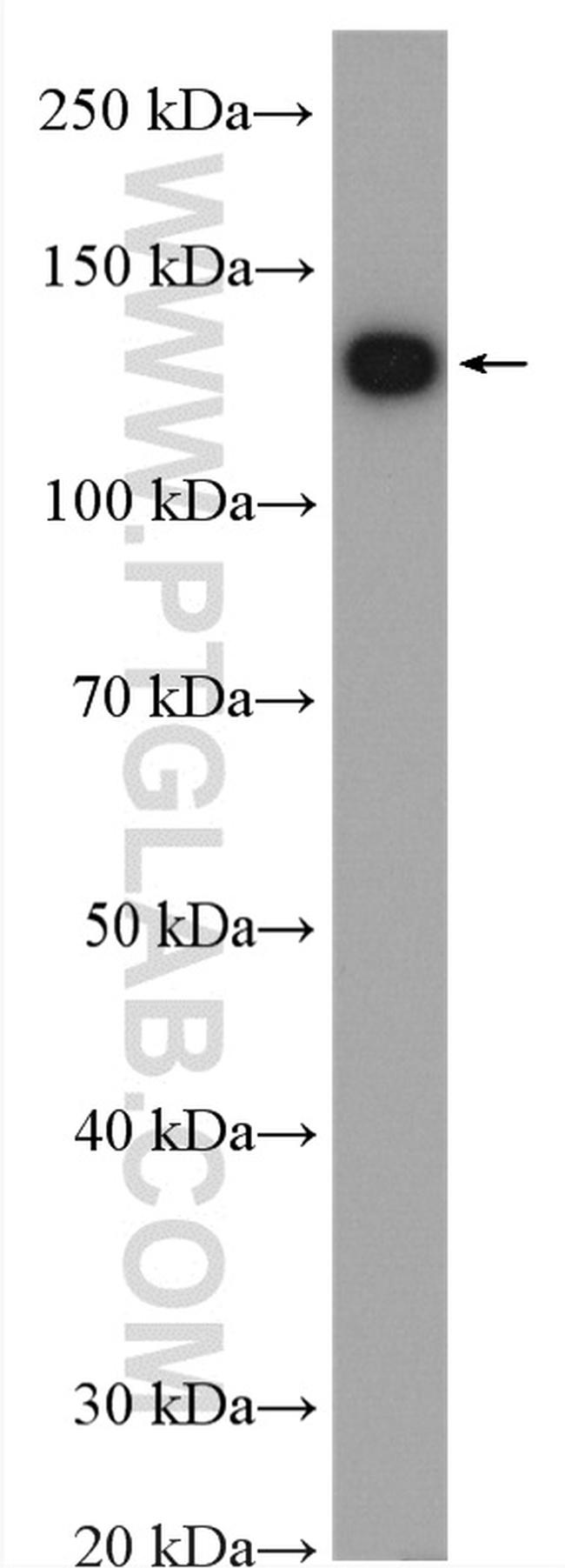 Phospholipase C beta 1 Antibody in Western Blot (WB)