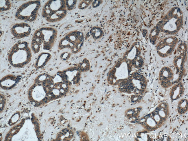 Phospholipase C beta 1 Antibody in Immunohistochemistry (Paraffin) (IHC (P))