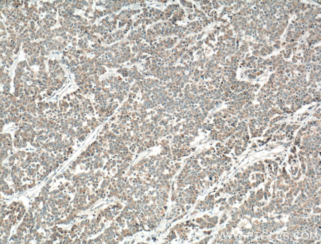 FGF9 Antibody in Immunohistochemistry (Paraffin) (IHC (P))