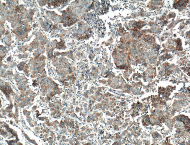 FGF9 Antibody in Immunohistochemistry (Paraffin) (IHC (P))