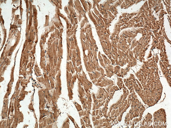 CPT2 Antibody in Immunohistochemistry (Paraffin) (IHC (P))