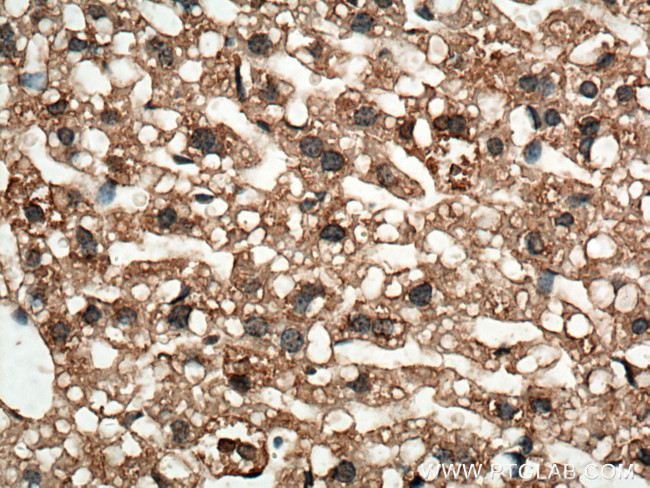 CPT2 Antibody in Immunohistochemistry (Paraffin) (IHC (P))