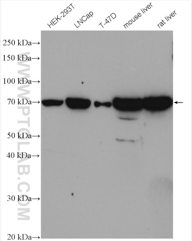 CPT2 Antibody in Western Blot (WB)