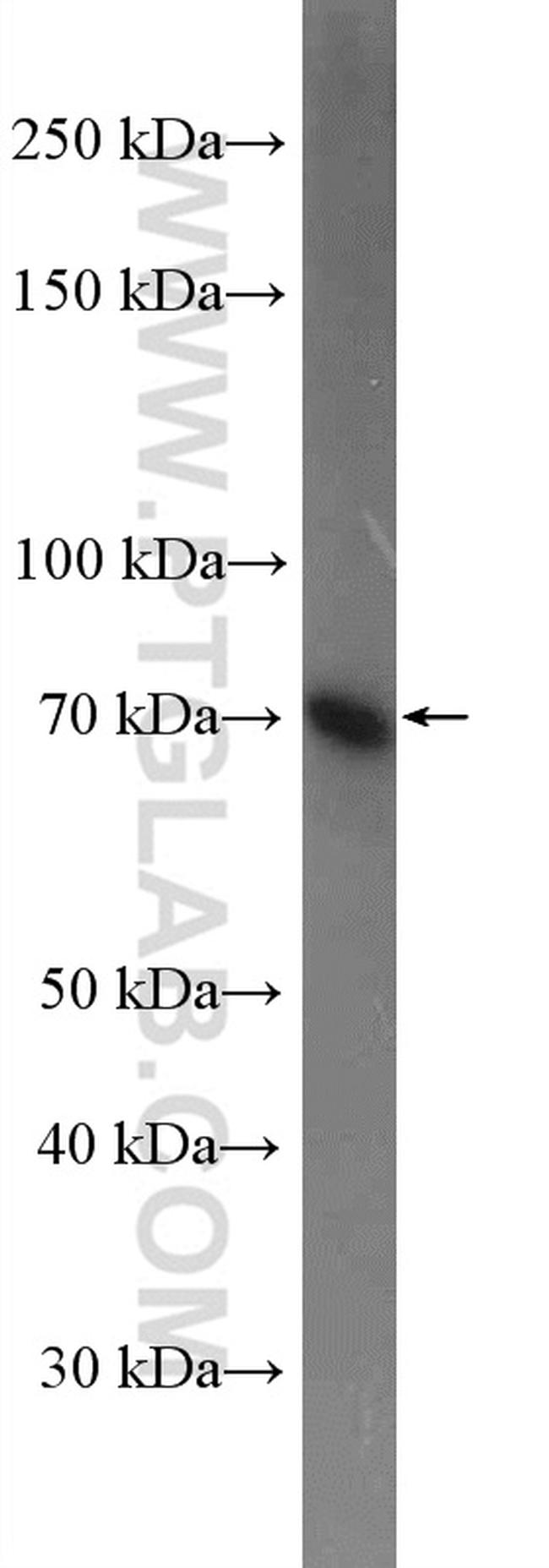 CPT2 Antibody in Western Blot (WB)