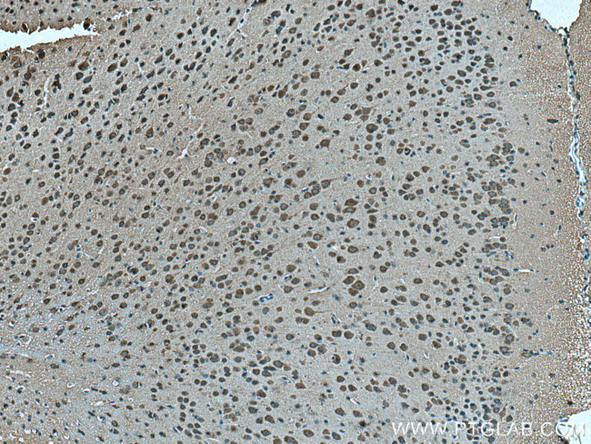 OAT1 Antibody in Immunohistochemistry (Paraffin) (IHC (P))