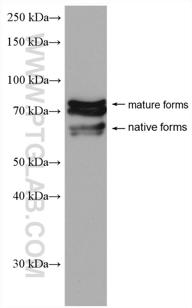 OAT1 Antibody in Western Blot (WB)