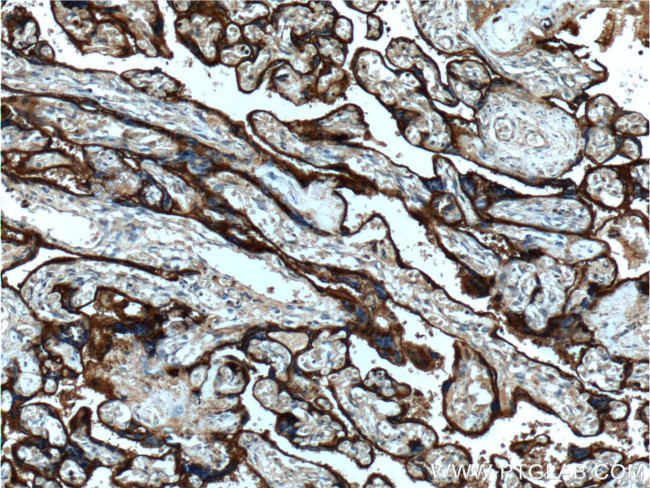 CD55 Antibody in Immunohistochemistry (Paraffin) (IHC (P))