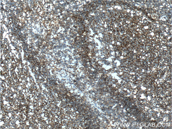 CD55 Antibody in Immunohistochemistry (Paraffin) (IHC (P))