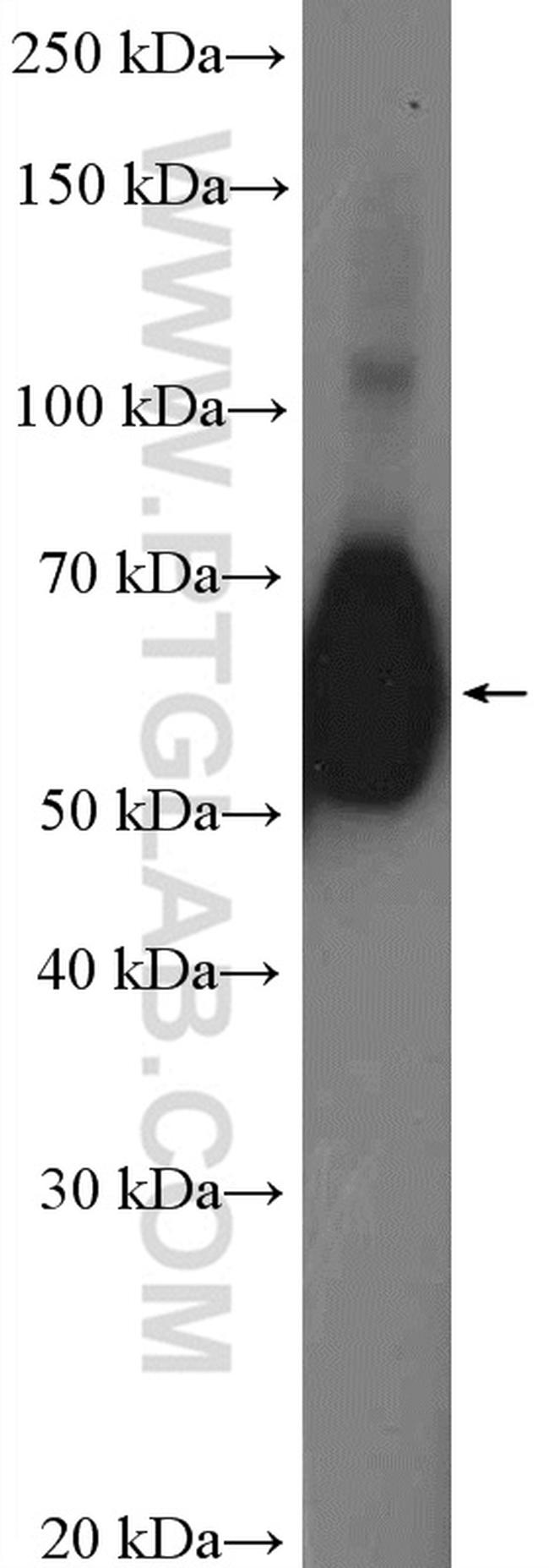 CD55 Antibody in Western Blot (WB)