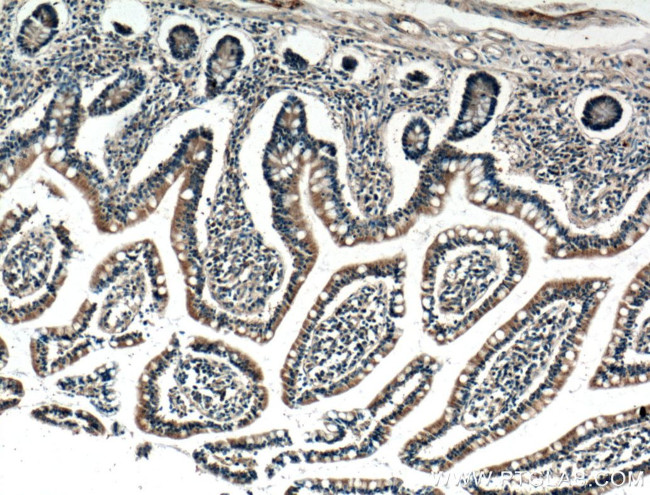 SCF Antibody in Immunohistochemistry (Paraffin) (IHC (P))