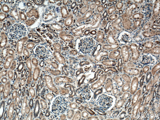 SCF Antibody in Immunohistochemistry (Paraffin) (IHC (P))