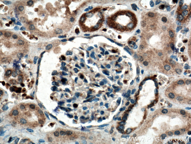 SCF Antibody in Immunohistochemistry (Paraffin) (IHC (P))