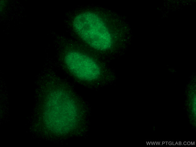 LIG3 Antibody in Immunocytochemistry (ICC/IF)