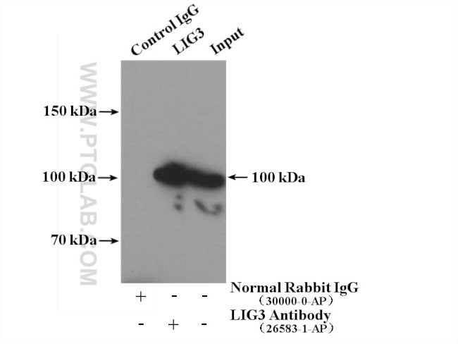 LIG3 Antibody in Immunoprecipitation (IP)