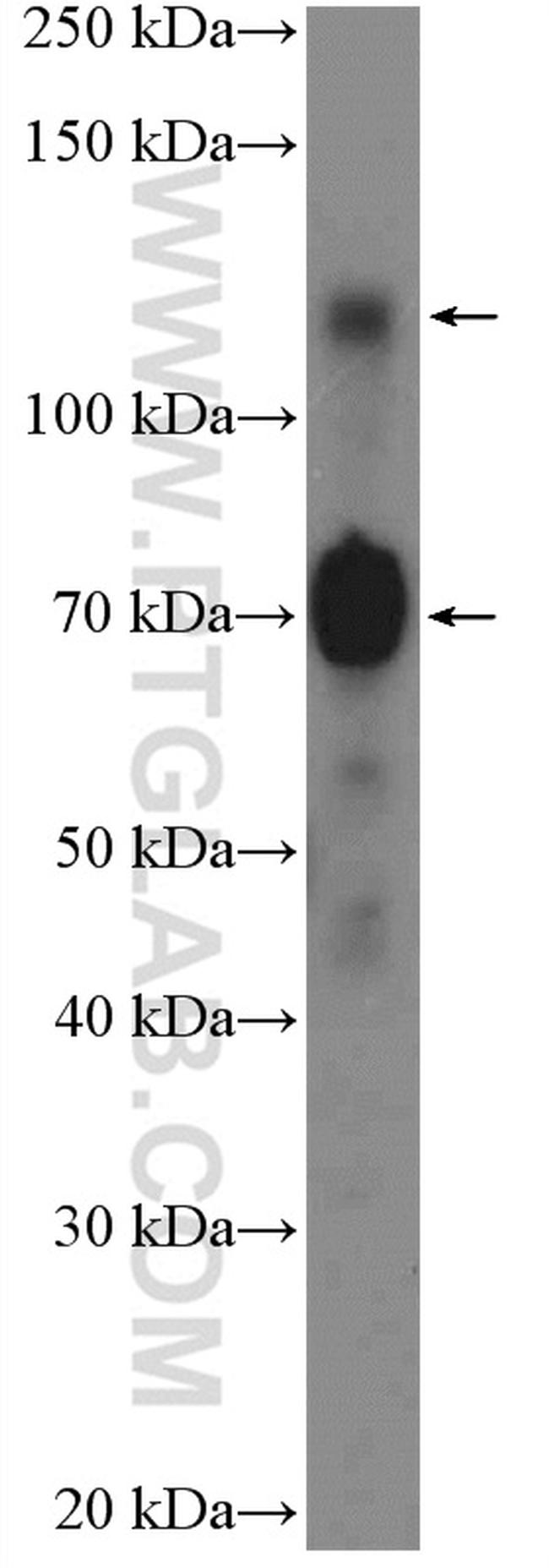 SP3 Antibody in Western Blot (WB)