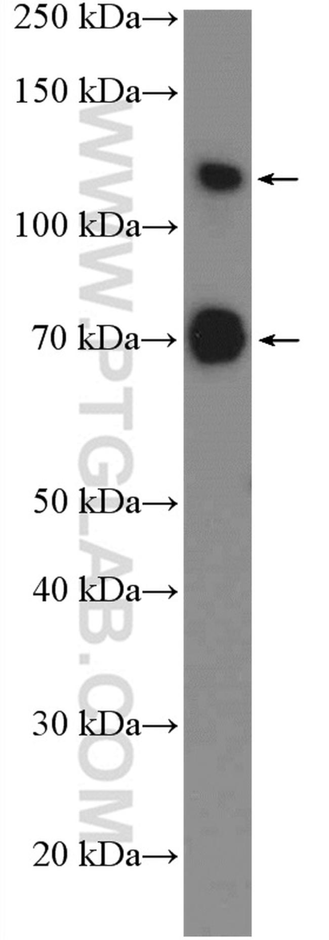 SP3 Antibody in Western Blot (WB)