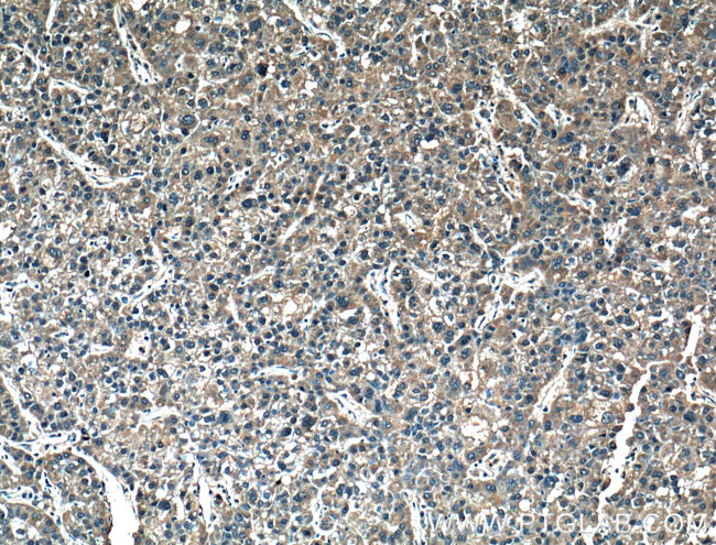 MMP1 Antibody in Immunohistochemistry (Paraffin) (IHC (P))