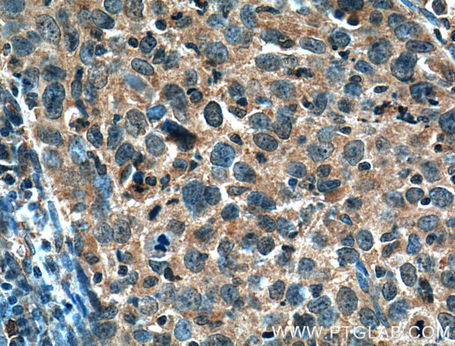 MMP1 Antibody in Immunohistochemistry (Paraffin) (IHC (P))