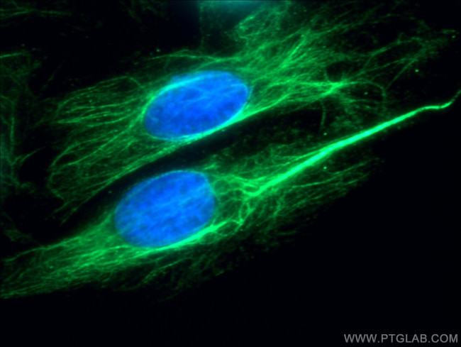 p70(S6K) Antibody in Immunocytochemistry (ICC/IF)