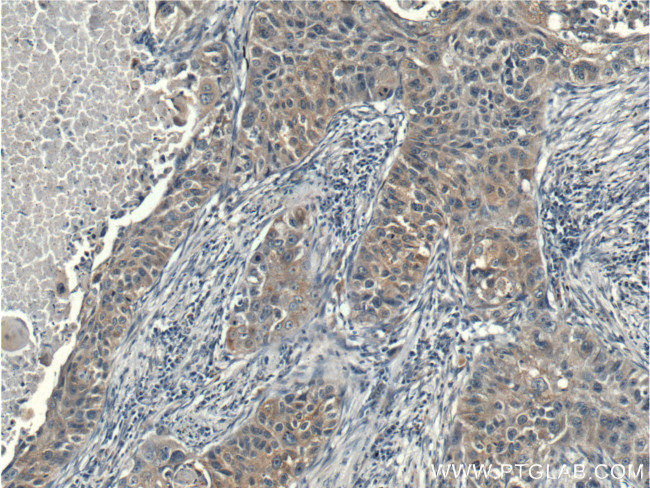 p70(S6K) Antibody in Immunohistochemistry (Paraffin) (IHC (P))