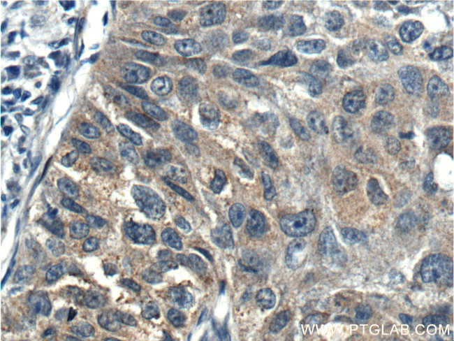 p70(S6K) Antibody in Immunohistochemistry (Paraffin) (IHC (P))