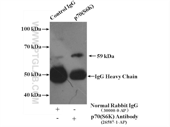 p70(S6K) Antibody in Immunoprecipitation (IP)