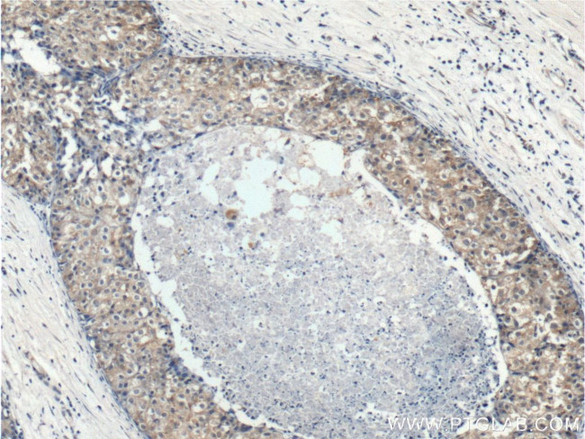 p70(S6K) Antibody in Immunohistochemistry (Paraffin) (IHC (P))