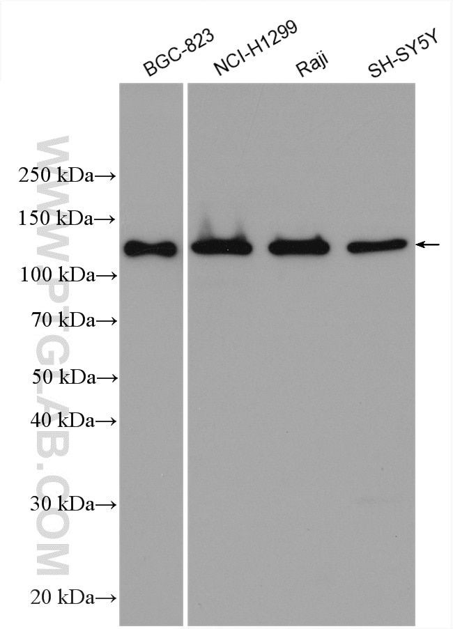 KCC4/SLC12A7 Antibody in Western Blot (WB)