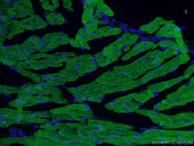 Cardiac Troponin T Antibody in Immunohistochemistry (PFA fixed) (IHC (PFA))