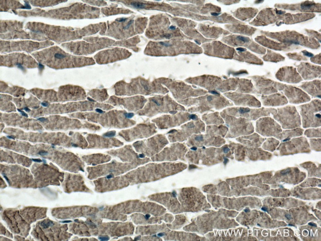 Cardiac Troponin T Antibody in Immunohistochemistry (Paraffin) (IHC (P))