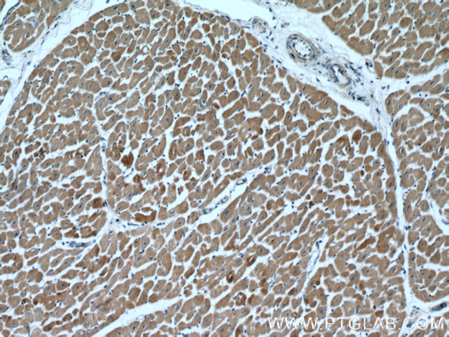 Cardiac Troponin T Antibody in Immunohistochemistry (Paraffin) (IHC (P))