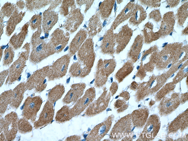 Cardiac Troponin T Antibody in Immunohistochemistry (Paraffin) (IHC (P))