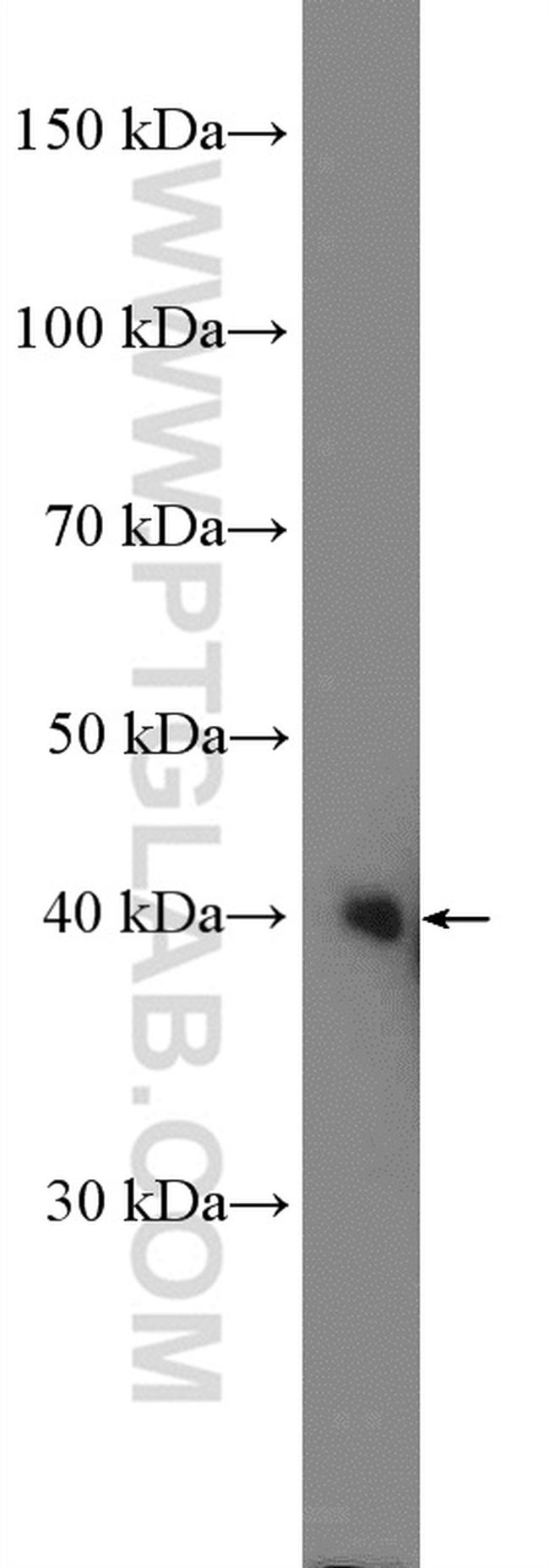 Cardiac Troponin T Antibody in Western Blot (WB)