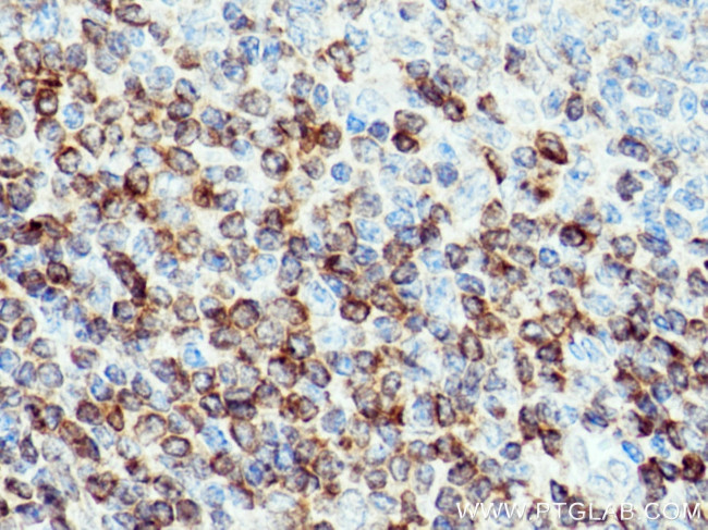 Bcl2 Antibody in Immunohistochemistry (Paraffin) (IHC (P))