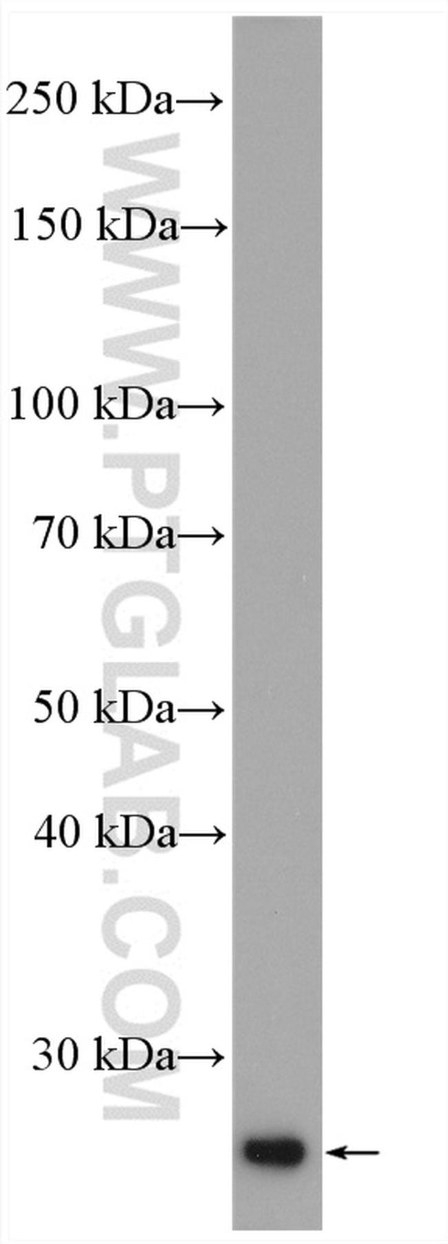 Bcl2 Antibody in Western Blot (WB)