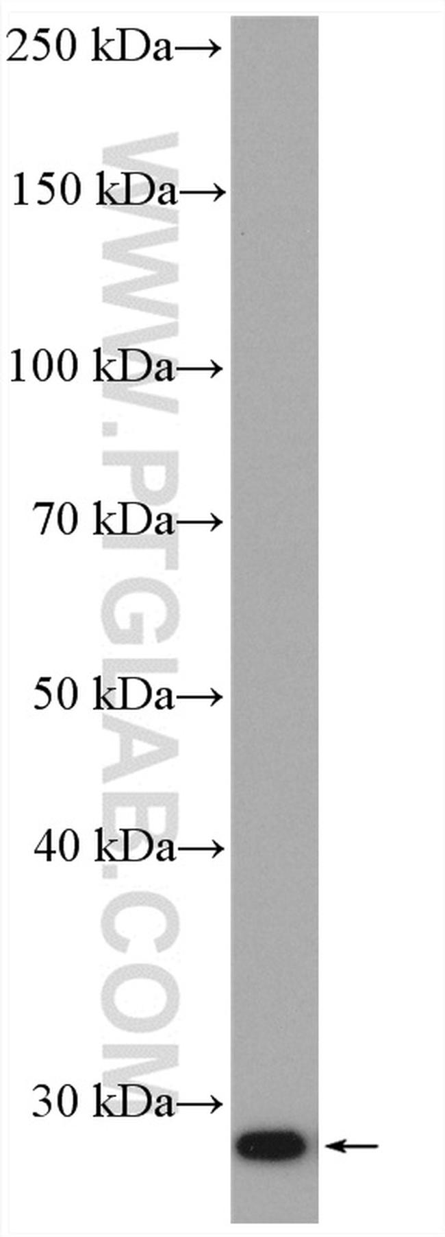 Bcl2 Antibody in Western Blot (WB)