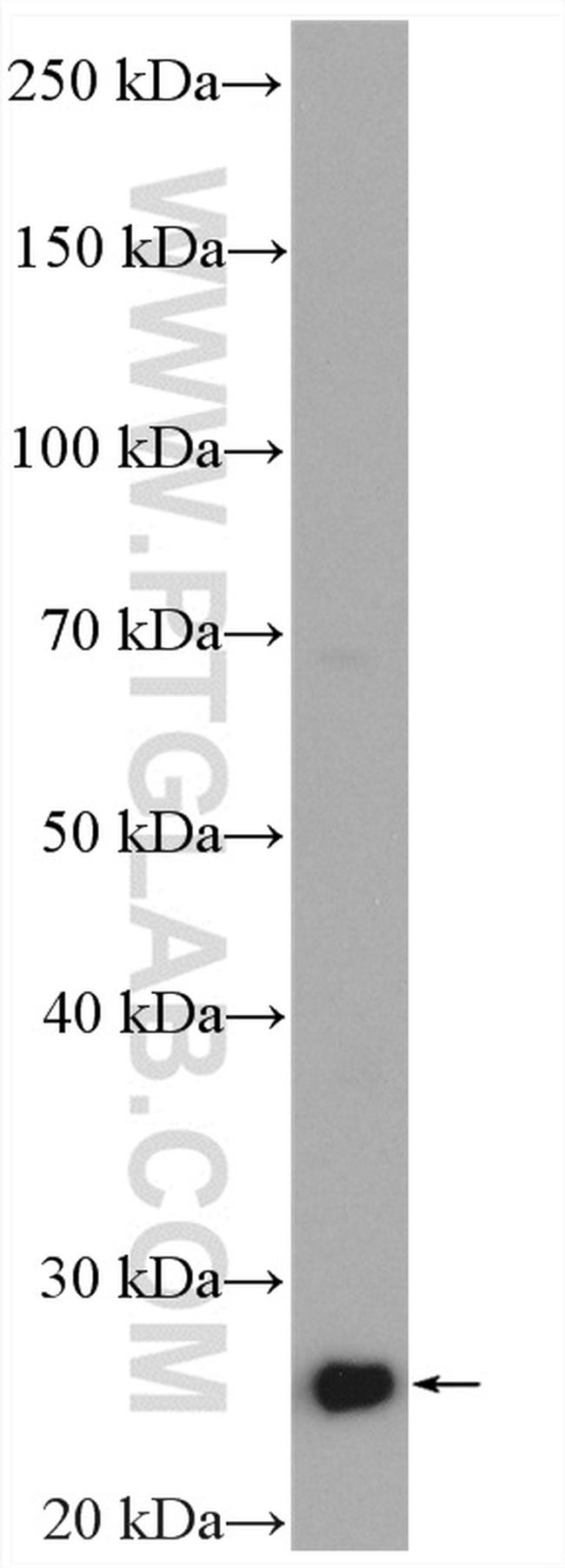 Bcl2 Antibody in Western Blot (WB)