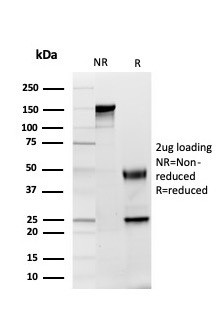 GDF8 (Growth Differentiation Factor 8)/Myostatin Antibody in SDS-PAGE (SDS-PAGE)