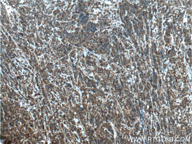 STK17B Antibody in Immunohistochemistry (Paraffin) (IHC (P))