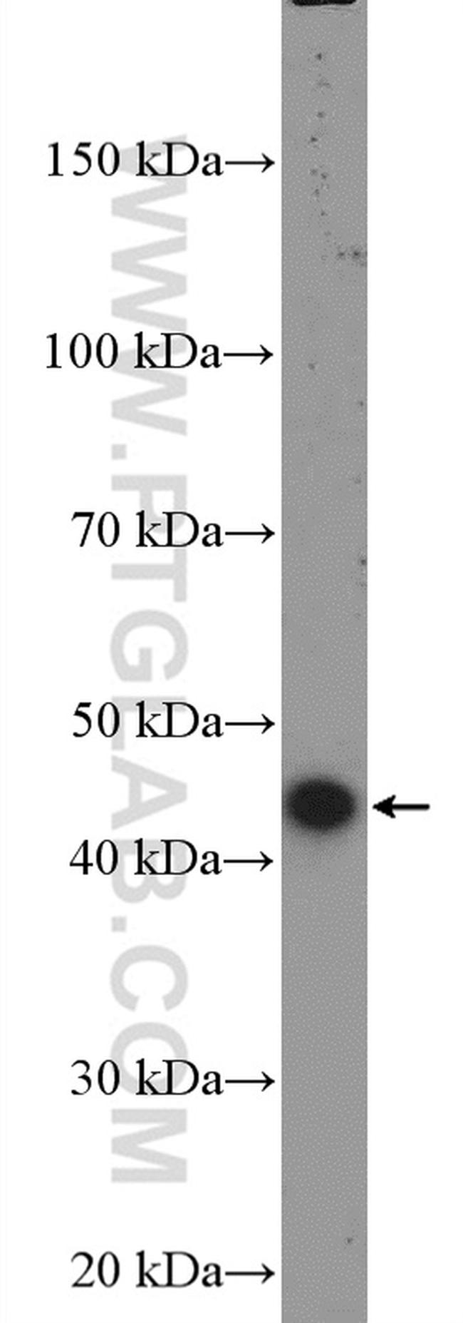 STK17B Antibody in Western Blot (WB)