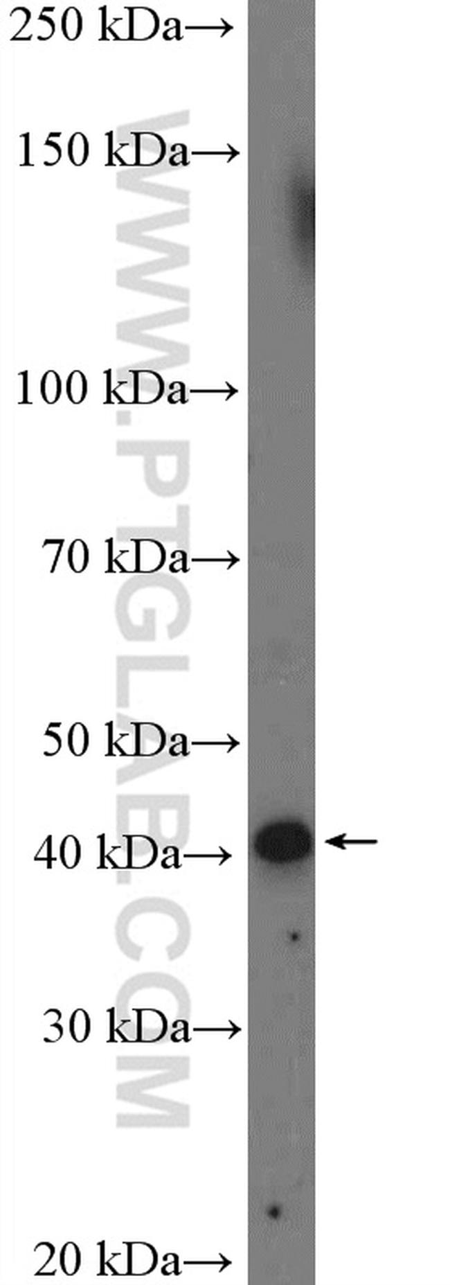 STK17B Antibody in Western Blot (WB)