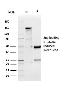 GDF9 (Growth Differentiation Factor 9) Antibody in SDS-PAGE (SDS-PAGE)