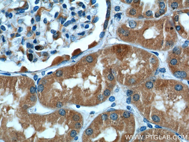 ALDH9A1 Antibody in Immunohistochemistry (Paraffin) (IHC (P))