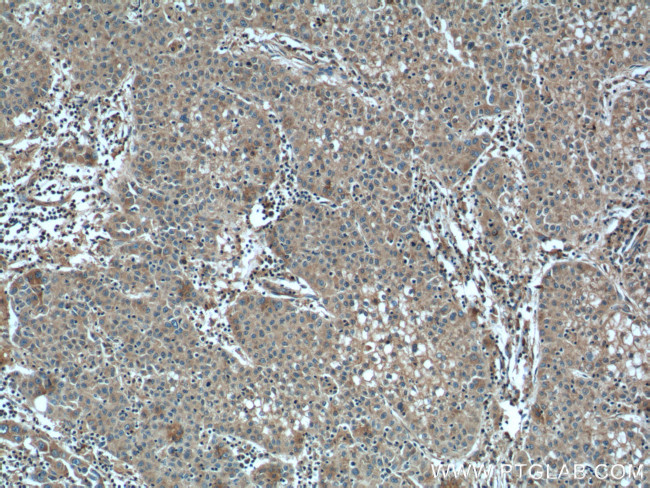 ALDH9A1 Antibody in Immunohistochemistry (Paraffin) (IHC (P))